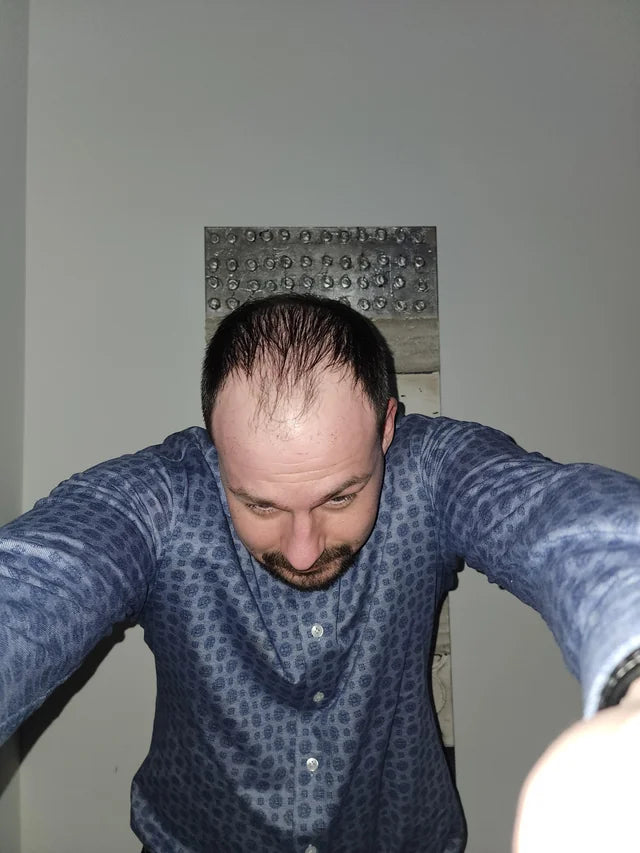 files/34-year-old-male-out-for-estimates-v0-87ed5whrw7kf1.webp